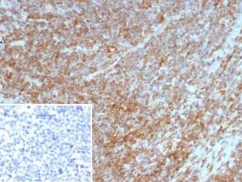 IHC staining of FFPE human tonsil tissue with Interleukin-7 antibody (clone IL7/4269). Inset: PBS used in place of primary Ab (secondary Ab negative control). HIER: boil tissue sections in pH 9 10mM Tris with 1mM EDTA for 20 min and allow to cool before testing.~