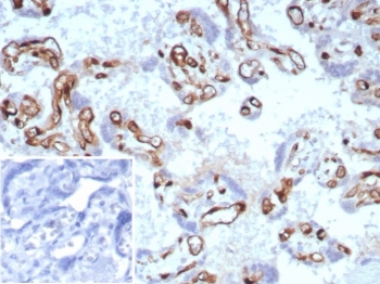 IHC staining of FFPE human placental tissue with FABP4 antibody (clone rFABP4/8536) at 2ug/ml. Inset: PBS used in place of primary Ab (secondary Ab negative control). HIER: boil tissue sections in pH 9 10mM Tris with 1mM EDTA for 20 min and allow to cool before testing.~