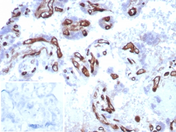 IHC staining of FFPE human placental tissue with Fatty Acid Binding Protein 4 antibody (clone FABP4/8537R) at 2ug/ml. Inset: PBS used in place of primary Ab (secondary Ab negative control). HIER: boil tissue sections in pH 9 10mM Tris with 1mM EDTA for 20 min and allow to cool before testing.~