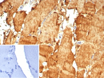 IHC staining of FFPE human skeletal muscle tissue with Carbonic Anhydrase 3 antibody (clone CA3/7883). Inset: PBS used in place of primary Ab (secondary Ab negative control). HIER: boil tissue sections in pH 9 10mM Tris with 1mM EDTA for 20 min and allow to cool before testing.~