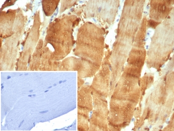 IHC staining of FFPE human skeletal muscle tissue with Carbonic Anhydrase 3 antibody (clone CA3/7884). Inset: PBS used in place of primary Ab (secondary Ab negative control). HIER: boil tissue sections in pH 9 10mM Tris with 1mM EDTA for 20 min and allow to cool before testing.~