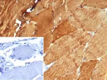 IHC staining of FFPE human skeletal muscle tissue with CA3 antibody (clone CA3/7885). Inset: PBS used in place of primary Ab (secondary Ab negative control). HIER: boil tissue sections in pH 9 10mM Tris with 1mM EDTA for 20 min and allow to cool before testing.~