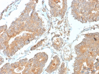 IHC staining of FFPE human prostate tissue with N-terminal EF-hand calcium binding protein 1 antibody (clone NECAB1/7676). HIER: boil tissue sections in pH 9 10mM Tris with 1mM EDTA for 20 min and allow to cool before testing.~