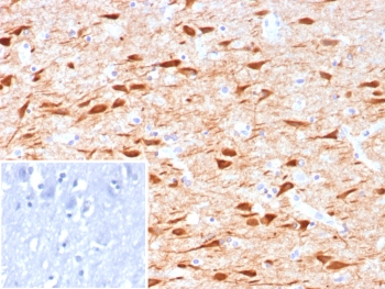 IHC staining of FFPE human brain tissue with NECAB1 antibody (clone NECAB1/7677). Inset: PBS used in place of primary Ab (secondary Ab negative control). HIER: boil tissue sections in pH 9 10mM Tris with 1mM EDTA for 20 min and allow to cool before testing.~