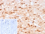IHC staining of FFPE human brain tissue with NECAB1 antibody (clone NECAB1/7677). Inset: PBS used in place of primary Ab (secondary Ab negative control). HIER: boil tissue sections in pH 9 10mM Tris with 1mM EDTA for 20 min and allow to cool before testing.
