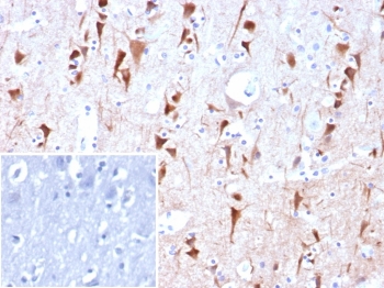 IHC staining of FFPE human brain tissue with NECAB1 antibody (clone NECAB1/7680). Inset: PBS used in place of primary Ab (secondary Ab negative control). HIER: boil tissue sections in pH 9 10mM Tris with 1mM EDTA for 20 min and allow to cool before testing.~