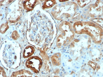 IHC staining of FFPE human kidney tissue with CALB1 antibody (clone rCALB1/8499). HIER: boil tissue sections in pH 9 10mM Tris with 1mM EDTA for 20 min and allow to cool before testing.~