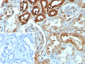 IHC staining of FFPE human kidney tissue with CALB1