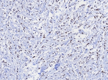 IHC staining of FFPE human uterus tissue with TRPS1 antibody; Strong nuclear staining observed with TRPS1/8131R at 2ug/ml. HIER: boil tissue sections in pH 9 10mM Tris with 1mM EDTA for 20 min and allow to cool before testing.~