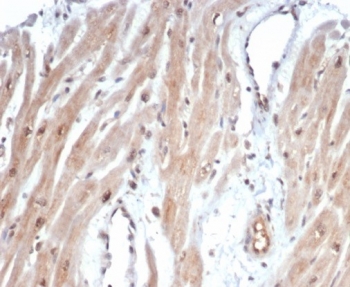 IHC staining of FFPE human heart tissue with c-Myc an
