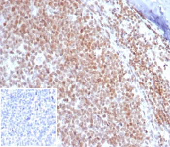 IHC staining of FFPE human tonsil tissue with c-Myc antibody (clone MYC/7854R). Inset: PBS used in place of primary Ab (secondary Ab negative control). HIER: boil tissue sections in pH 9 10mM Tris with 1mM EDTA for 20 min and allow to cool before testing.~