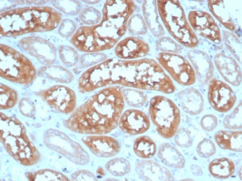 IHC staining of FFPE human kidney tissue with Adenylyl cyclase 8 antibody (clone ADCY8/7574). HIER: boil tissue sections in pH 9 10mM Tris with 1mM EDTA for 20 min and allow to cool before testing.~
