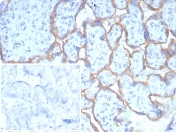 IHC staining of FFPE human placental tissue with PD-L1 antibody (clone PDL1/8408R). HIER: boil tissue sections in pH 9 10mM Tris with 1mM EDTA for 20 min and allow to cool before testing.~