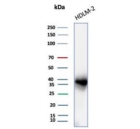 Western blot testing of human HDLM-2 cell lysate with PD-L1 antibody (clone PDL1/8222R). Predicted molecular weight ~34 kDa (unmodified), 45-70 kDa (glycosylated).~