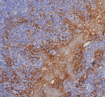 IHC staining of FFPE human tonsil tissue with PD-L1 antibody (clone PDL1/8