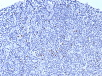 IHC staining of FFPE human tonsil tissue with Forkhead box protein P3 antibody (clone FOXP3/8015R). HIER: boil tissue sections in pH 9 10mM Tris with 1mM EDTA for 20 min and allow to cool before testing.~