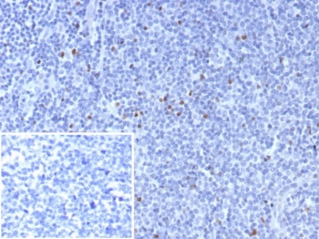 IHC staining of FFPE human tonsil