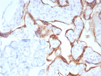 IHC staining of FFPE human placental tissue with Pappalysin-1 antibody (clone PAPPA/8804R). Inset: PBS used in place of primary Ab (secondary Ab negative control). HIER: boil tissue sections in pH 9 10mM Tris with 1mM EDTA for 20 min and allow to cool before testing.~