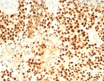 IHC staining of FFPE human adrenal cortex with Steroidogenic Factor 1 antibody (clone SF1/8000R). HIER: boil tissue sections in pH 9 10mM Tris with 1mM EDTA for 20 min and allow to cool before testing.~