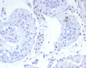 IHC staining of FFPE human testis tissue with SF-1 antibody (clone SF1/8150R). HIER: boil tissue sections in pH 9 10mM Tris with 1mM EDTA for 20 min and allow to cool before testing.~