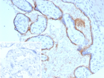 IHC staining of FFPE human placental tissue with Endoglin antibody (clone ENG/4750) Inset: PBS used in place of primary Ab (secondary Ab negative control). HIER: boil tissue sections in pH 9 10mM Tris with 1mM EDTA for 20 min and allow to cool before testing.~