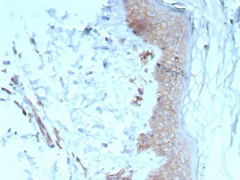 IHC staining of FFPE human skin tissue with Pan-Cadherin antibody (clone Pan-CAD/8020). HIER: boil tissue sections in pH 9 10mM Tris with 1mM EDTA for 20 min and allow to cool before testing.~