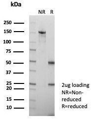 SDS-PAGE analysis of purified, BSA-free HBsAg a