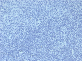IHC staining of FFPE human tonsil tissue with Mouse IgG2a Isotype Control antibody (clone IGG2a/6723). HIER: boil tissue sections in pH 9 10mM Tris with 1mM EDTA for 20 min and allow to cool before testing.~