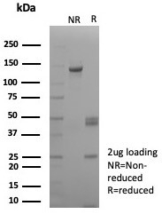 SDS-PAGE analysis of purified, BSA-free Biotin antibody (clone rBTN/8819) as confirmation of inte