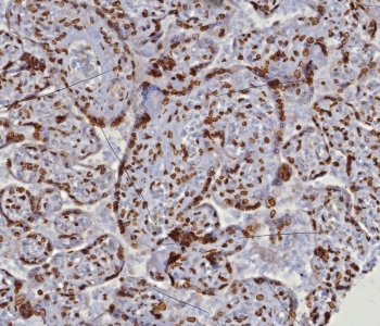 IHC staining of FFPE human placental tissue with dsDNA antibody (clone DSD/8204R). HIER: boil tissue sections in pH 9 10mM Tris with 1mM EDTA for 20 min and allow to cool before testing.~
