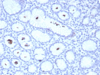 IHC staining of FFPE human H. pylori-infected stomach tissue with Helicobacter pylori antibody (clone HPYL/8548R). HIER: boil tissue sections in pH 9 10mM Tris with 1mM EDTA for 20 min and allow to cool before testing.~