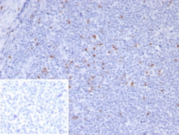 IHC staining of FFPE human tonsil tissue with Scurfin antibody (clone FOXP3/8145R). Inset: PBS used in place of primary Ab (secondary Ab negative control). HIER: boil tissue sections in pH 9 10mM Tris with 1mM EDTA for 20 min and allow to cool before testing.~