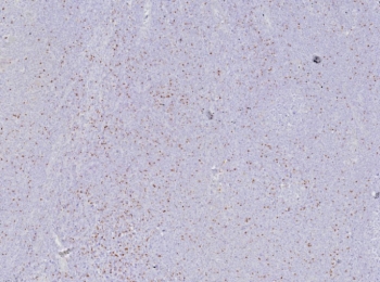 IHC staining of FFPE human tonsil tissue with FOXP3 antibody (clone FOXP3/8277R). HIER: boil tissue sections in pH 9 10mM Tris with 1mM EDTA for 20 min and allow to cool before testing.~
