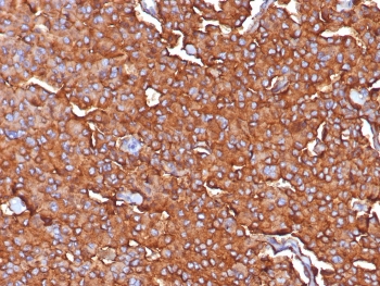 IHC staining of FFPE human adrenal tissue with Synaptophysin antibody (clone SYP/7976R). HIER: boil tissue sections in pH 9 10mM Tris with 1mM EDTA for 20 min and allow to cool before testing.~