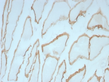IHC staining of FFPE human skeletal muscle tissue with Dystrophin antibody (clone DMD/8773R). HIER: boil tissue sections in pH 9 10mM Tris with 1mM EDTA for 20 min and allow to cool before testing.~