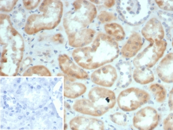 IHC staining of FFPE human kidney tissue with S100G antibody (clone S100G/7461). Inset: PBS used in place of primary Ab (secondary Ab negative control). HIER: boil tissue sections in pH 9 10mM Tris with 1mM EDTA for 20 min and allow to cool before testing.~