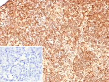 IHC staining of FFPE human lymph node tissue with Calbindin D9K antibody (clone S100G/7517). Inset: PBS used in place of primary Ab (secondary Ab negative control). HIER: boil tissue sections in pH 9 10mM Tris with 1mM EDTA for 20 min and allow to cool before testing.~