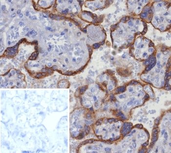 IHC staining of FFPE human placental tissue with Glypican-3 antibody (clone GPC3/8363R). Inset: PBS used in place of primary Ab (secondary Ab negative control). HIER: boil tissue sections in pH 9 10mM Tris with 1mM EDTA for 20 min and allow to cool before testing.~