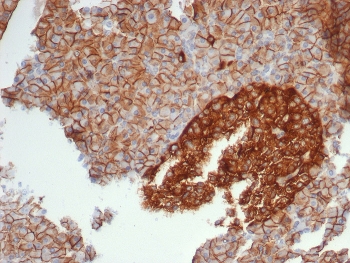 IHC staining of FFPE human pancreas tissue with CD99 antibody (clone MIC2/7861). HIER: boil tissue sections in pH 9 10mM Tris with 1mM EDTA for 20 min and allow to cool before testing.~