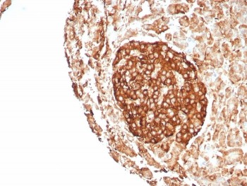 IHC staining of FFPE human pancreas tissue with CD99 antibody (clone rMIC2/8746). HIER: boil tissue sections in pH 9 10mM Tris with 1mM EDTA for 20 min and allow to cool before testing.~