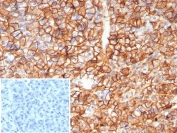 IHC staining of FFPE human pancreas tissue with CD99 antibody (clone MIC2/8119R). Inset: PBS used in place of primary Ab (secondary Ab negative control). HIER: boil tissue sections in pH 9 10mM Tris with 1mM EDTA for 20 min and allow to cool before testing.