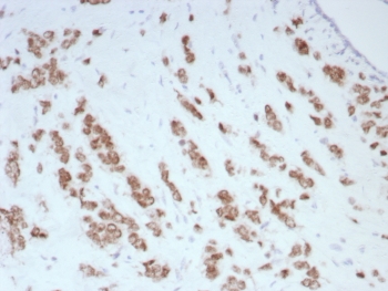 IHC staining of FFPE human br