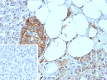 IHC staining of FFPE human pancreas tissue with CD99