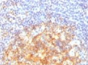 IHC testing of FFPE human tonsil with VCAM-1 antibody (clone CDLA106).
