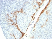IHC testing of FFPE human tonsil with recombinant Cytokeratin 16 antibody (clone rKRT16/1714). Required HIER: boil tissue sections in pH6, 10mM citrate buffer, for 10-20 min followed by cooling at RT for 20 min.