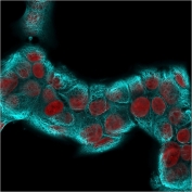 Immunofluorescent staining of permeabilized human MCF7 cells with recombinant Cytokeratin 18 antibody (clone KRT18/2819R, blue) and Reddot nuclear stain (red).