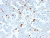 IHC staining of FFPE human colon tissue with recombinant MUC2 antibody (clone MLP/2970R). HIER: boil tissue sections in 10mM Tris-HCl buffer, pH 10, for 10-20 min and allow to cool before testing.