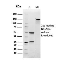 SDS-PAGE analysis of purified, BSA-free RAC1 antibody as confirmation of integrity and purity.