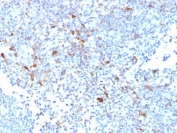IHC testing of FFPE human lymph node with TRAF1 antibody (clone TRAF1/2770). HIER: boil tissue sections in pH6, 10mM citrate buffer, for 10-20 min followed by cooling at RT for 20 min.