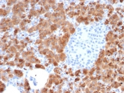IHC testing of FFPE human pancreas with Carboxypeptidase A1 antibody (clone CPA1/2714). HIER: boil tissue sections in pH6, 10mM citrate buffer, for 10-20 min followed by cooling at RT for 20 min.